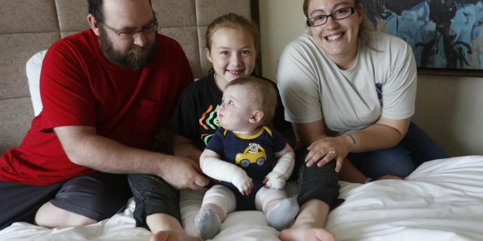 This is a photo of a smiling family with a baby with Epidermolysis Bullosa (EB).