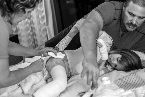 This photo is of parents and their young daughter during a bandage change.