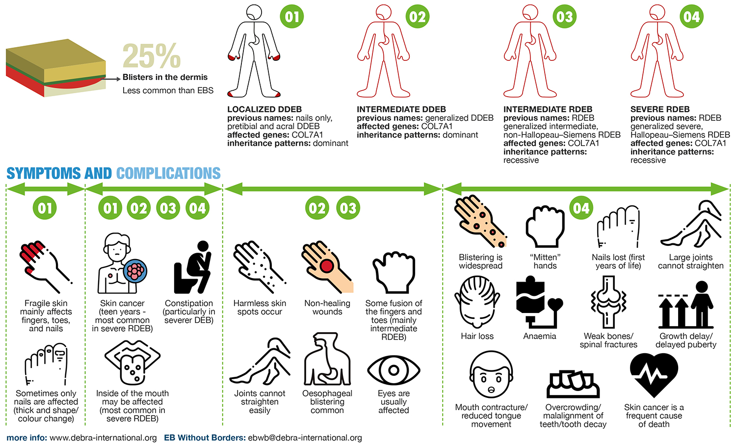 Dystrophic EB Infographic