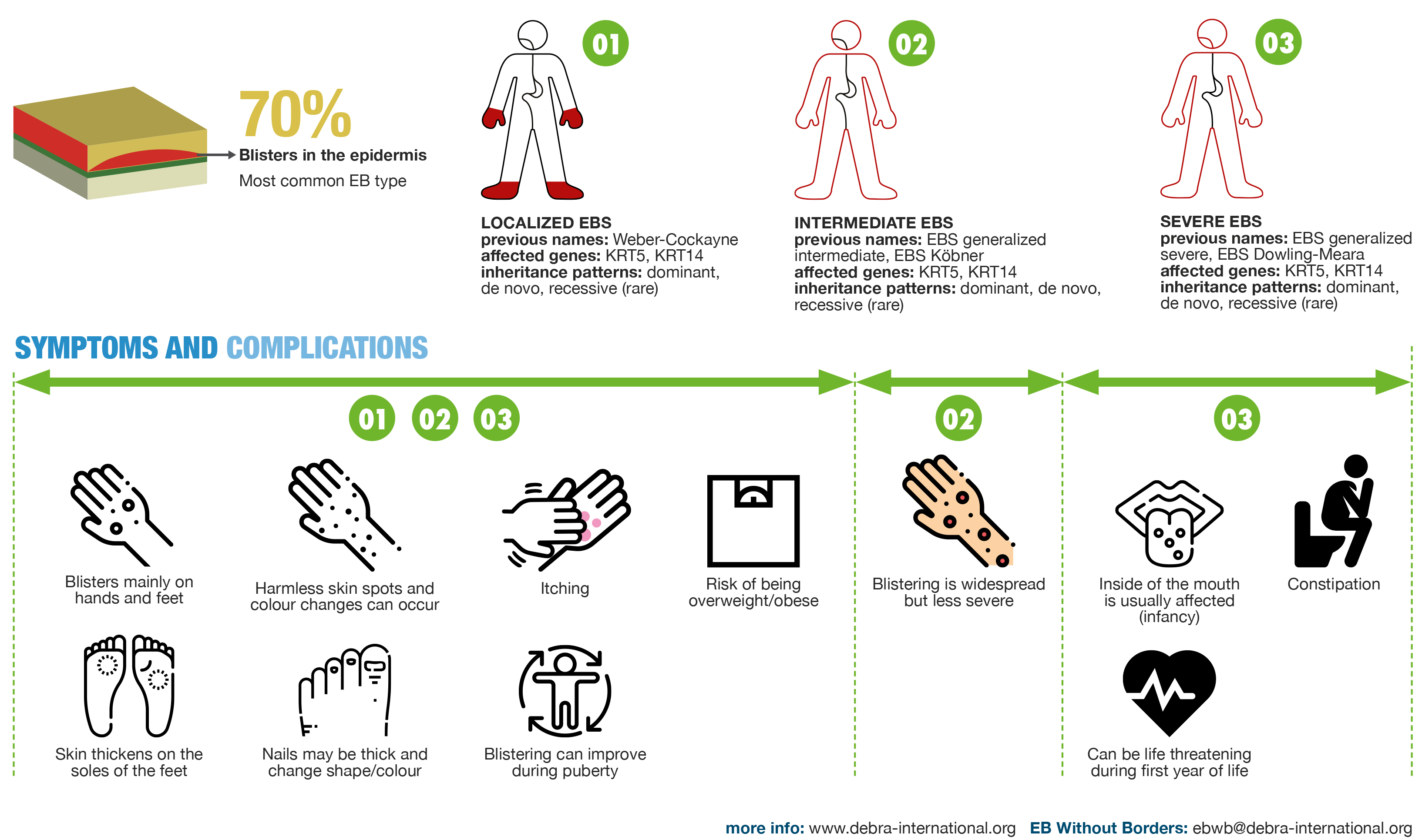 EB Simplex Infographic