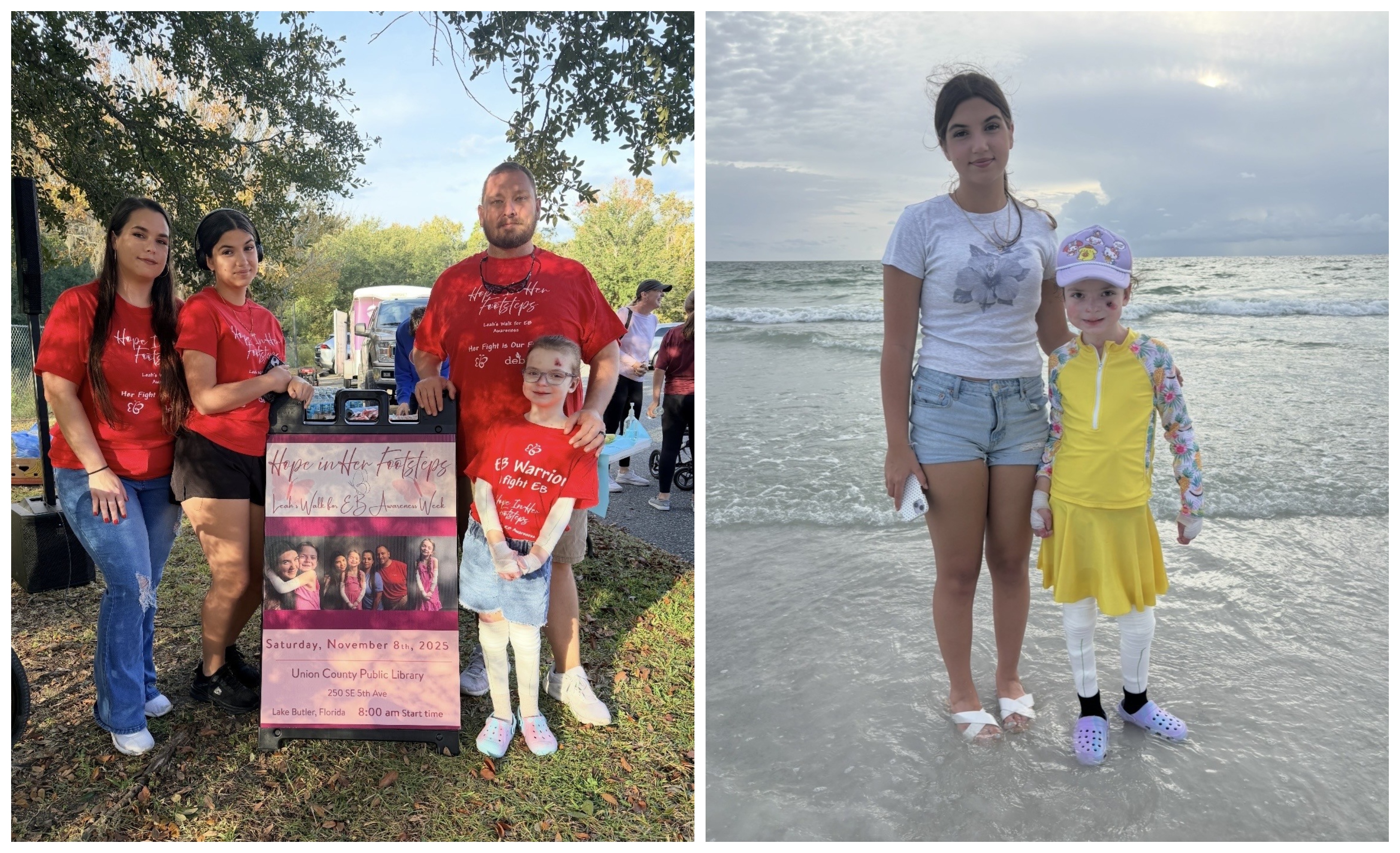 Leah's Walk for EB Awareness