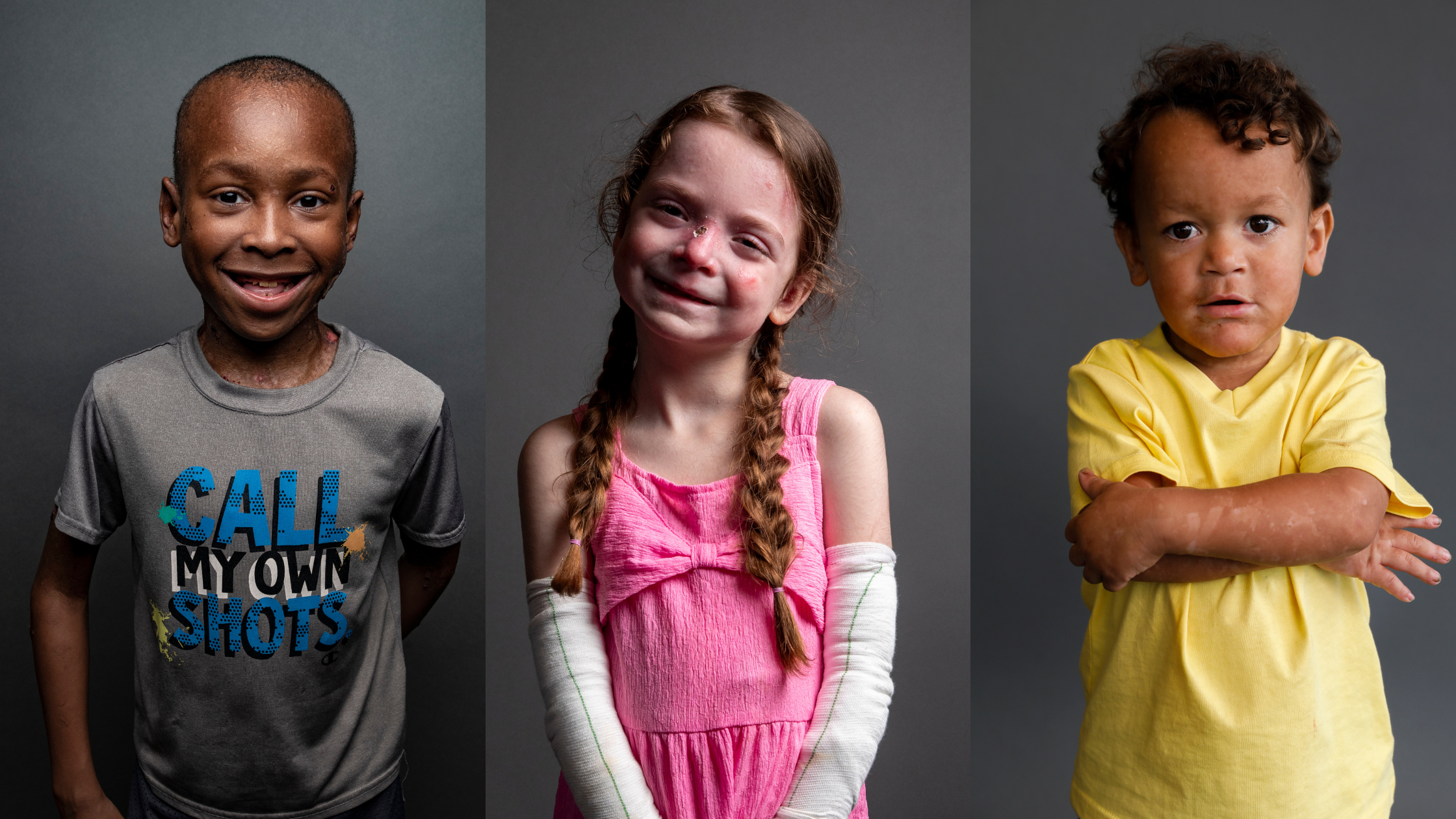 School and Epidermolysis Bullosa | debra of America