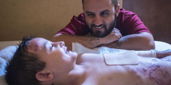 This photo is of a father by the bedside of his son with EB.