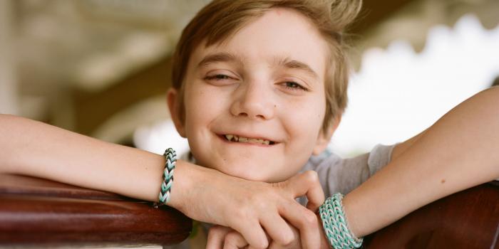 This photo is of a girl with Epidermolysis Bullosa (EB) smiling.