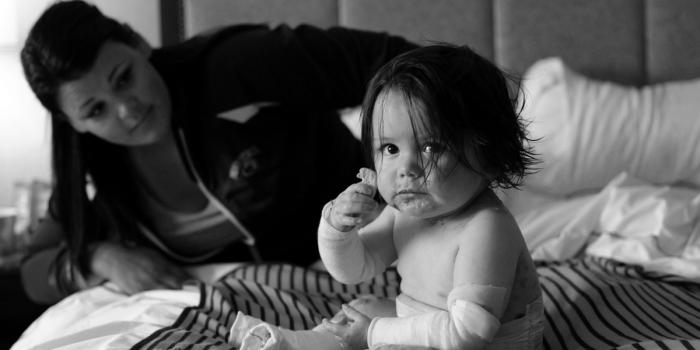 Infant with EB