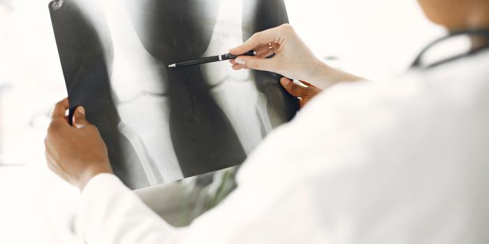 Epidermolysis Bullosa Bone Health