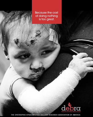 debra of America Corporate Brochure Cover