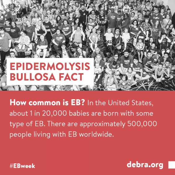 EB Fact 5