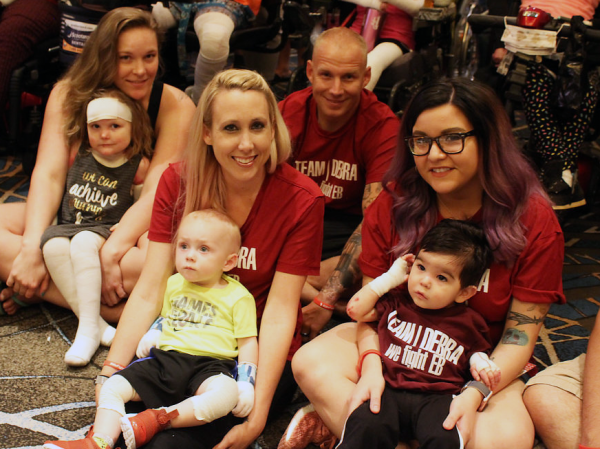 Families living with EB.