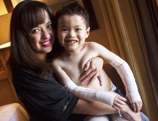 Epidermolysis Bullosa Wound Care Distribution Program