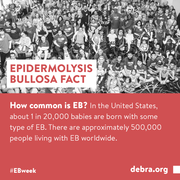 Epidermolysis Bullosa Awareness Week