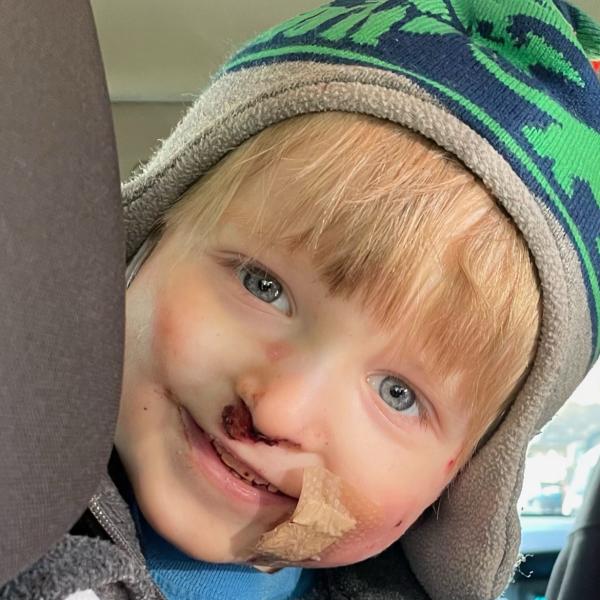 Epidermolysis Bullosa Personal Story